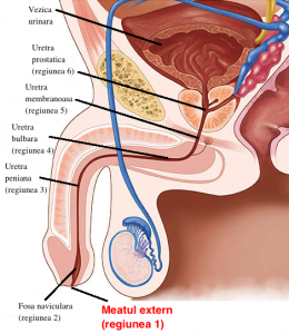 Excizie condiloame uretrale - Condilomul vezicii urinare, Condiloame în vezică la femei