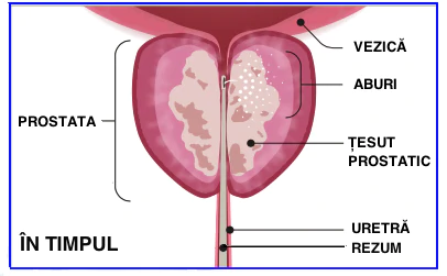 urinare frecventă în porții mici la bărbați medicamente pentru prostatita