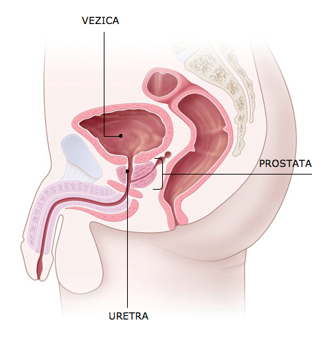 Adenomul de prostata — Tratament Naturist