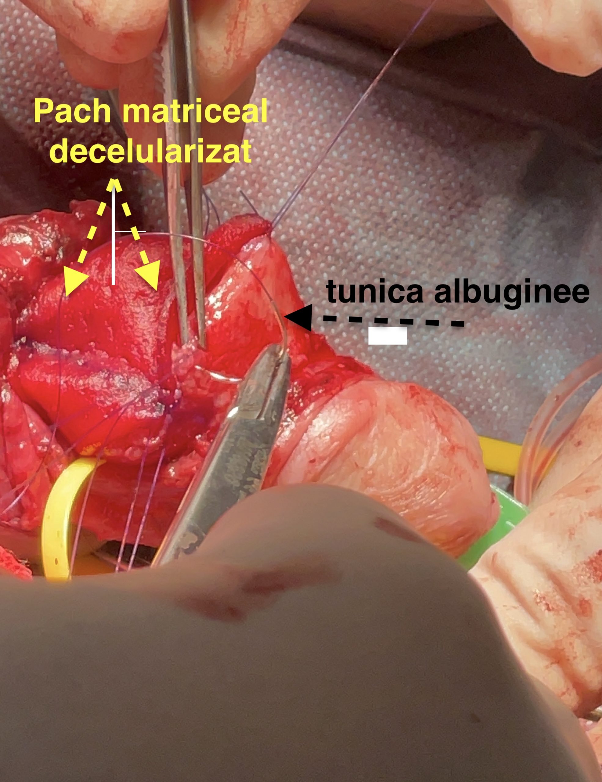 pach scaled